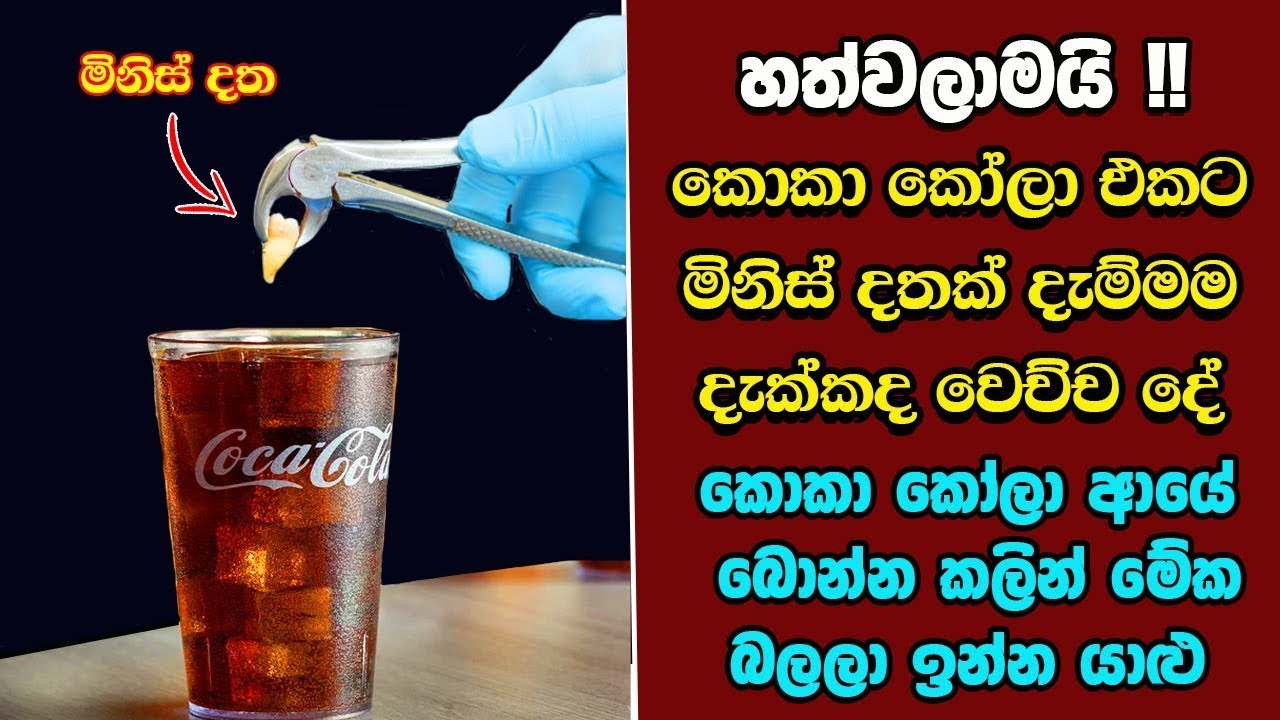 මුල් මාස හයේ Mr.පුදුමයගේ හොඳම ටික මෙන්න EP 03