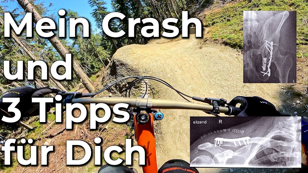 Mein Crash und was Du daraus lernen kannst - 3 Tipps für weniger Sorgen beim Biken