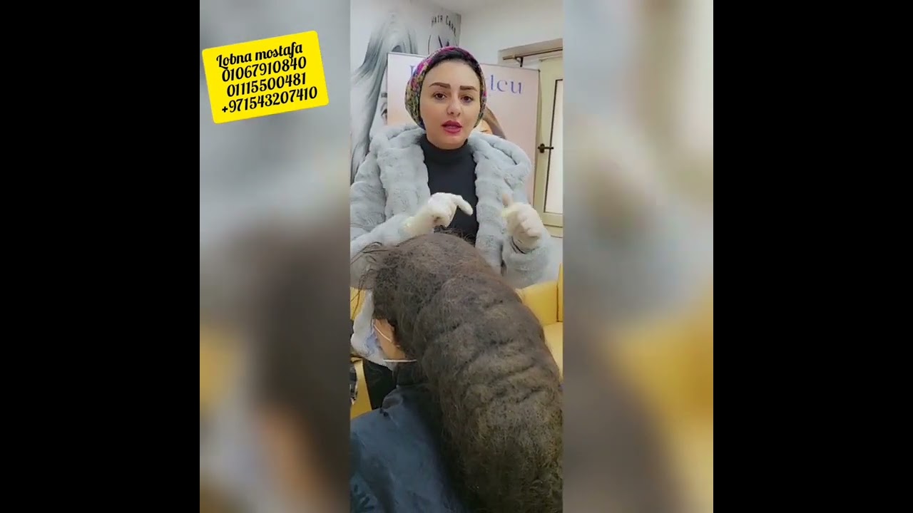 حل مشكلة الشعر الخشابي في جلسه واحده 👌واتس 01115500481