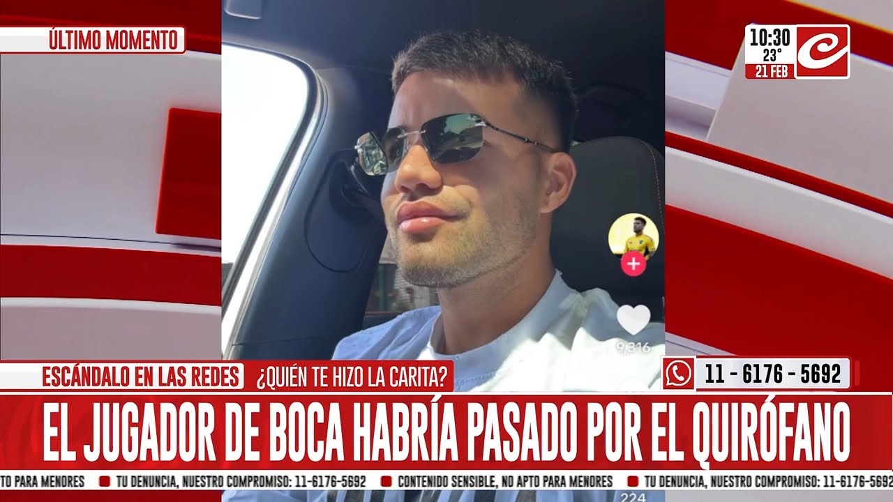 Jugador de Boca apareció con los labios operados y causó revuelo en las redes