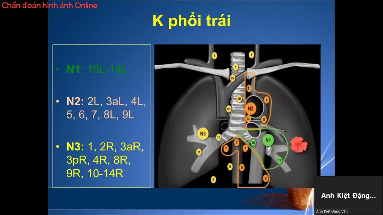 CT PHỔI | BS.CKI. ĐẶNG VĂN ANH KIỆT