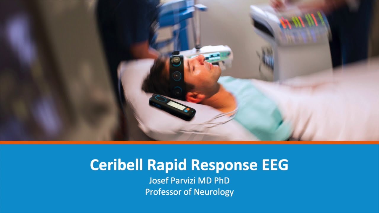 EEG Atlas A1: Why Time To Seizure Diagnosis Matters
