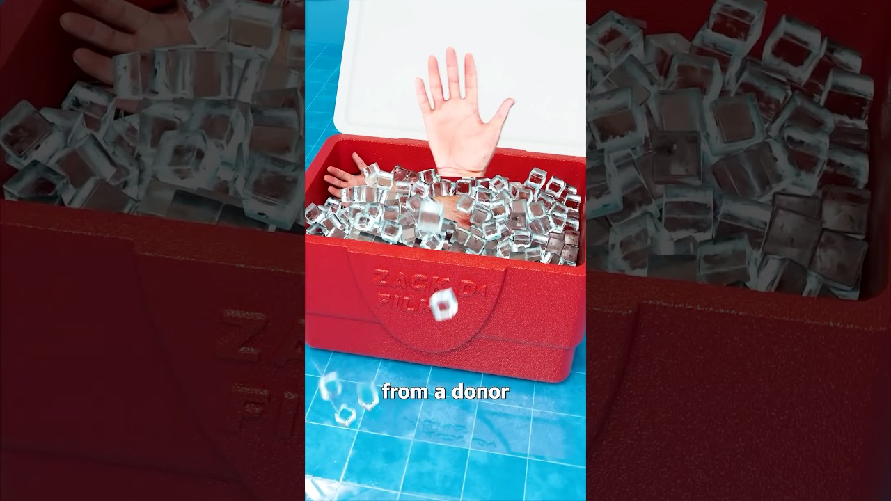 How A Hand Transplant Works ✋ Surgeon Reacts