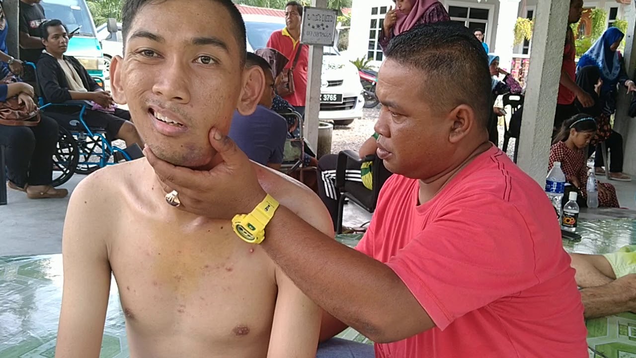 PATAH RAHANG..  dtg jumpa Wak Saiman dan anak buah..Rawatan patah TOP di Kuala Selangor..