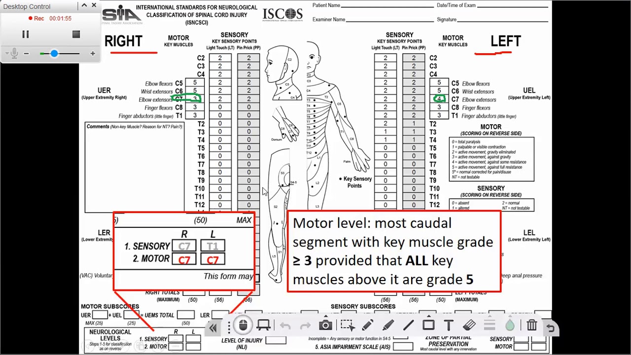 Determining the Motor Level