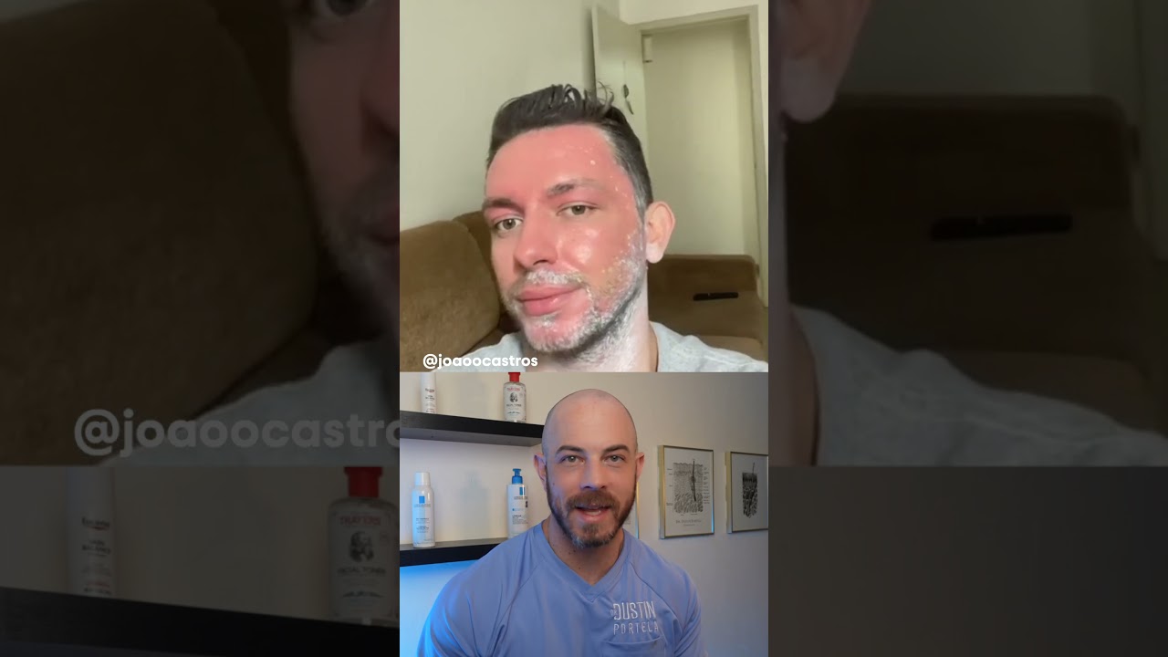 Dermatologist reacts to drastic phenol peel results! #dermreacts #phenolpeel