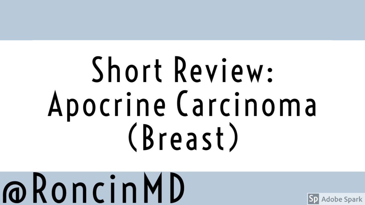 Short Review: Apocrine Carcinoma (Breast)