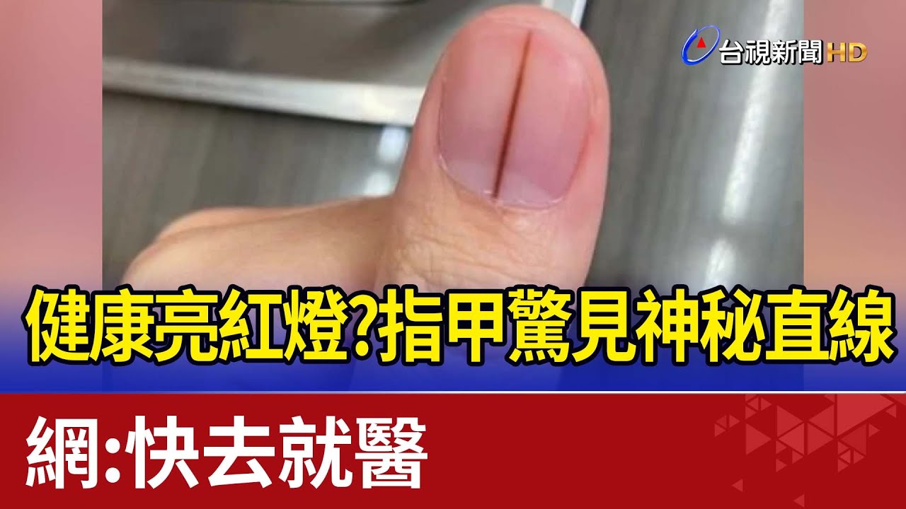 健康亮紅燈？指甲驚見神秘直線  網：快去就醫