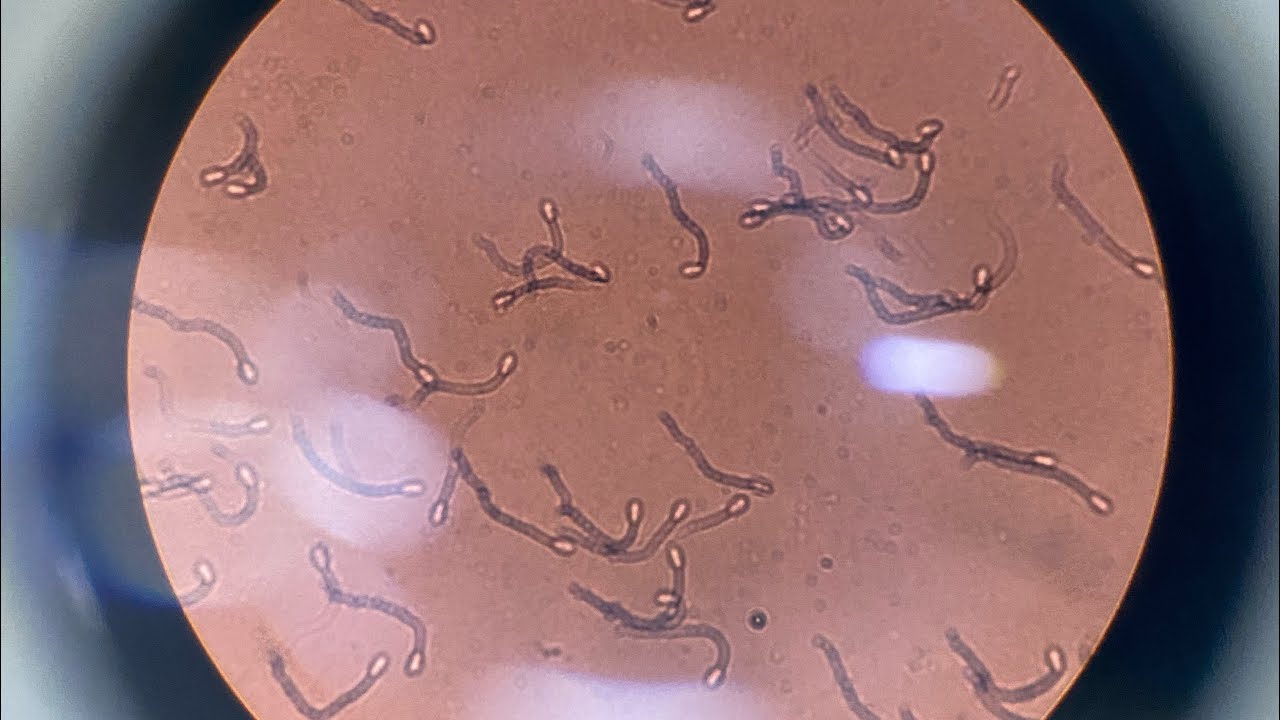 FANT&Aacute;STICO! GAMETAS MACULINOS VIVOS NO MICROSC&Oacute;PIO!