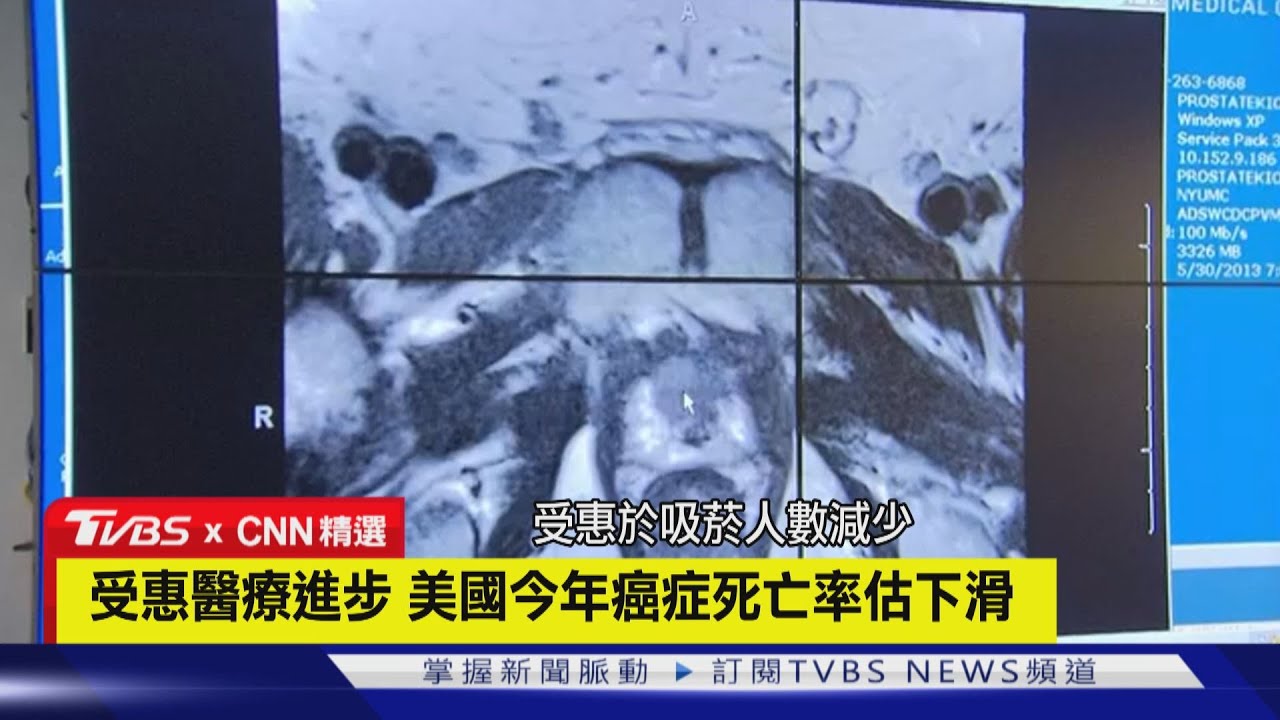【CNN精選】受惠醫療進步 美國今年癌症死亡率估下滑｜TVBS新聞 @TVBSNEWS01
