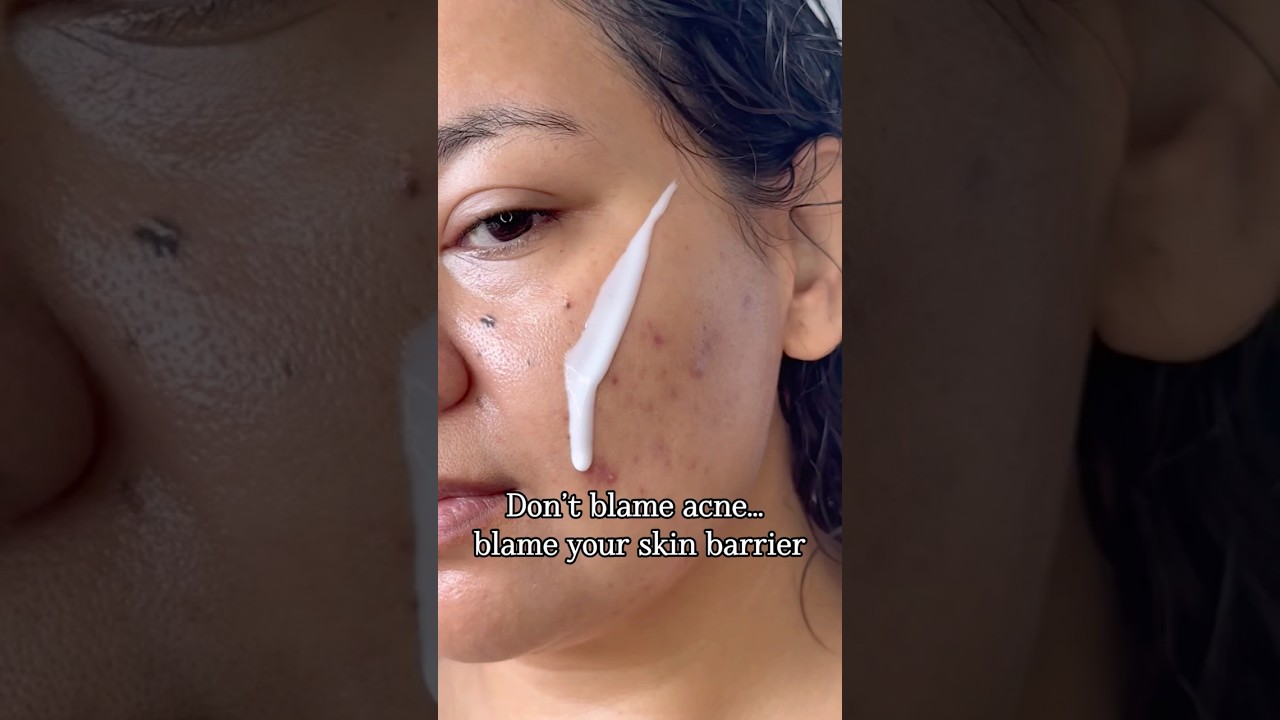 Kopher the new kbeauty brand fo acne #skincare #kbeauty #darkspots #brightskin #koreanskincare