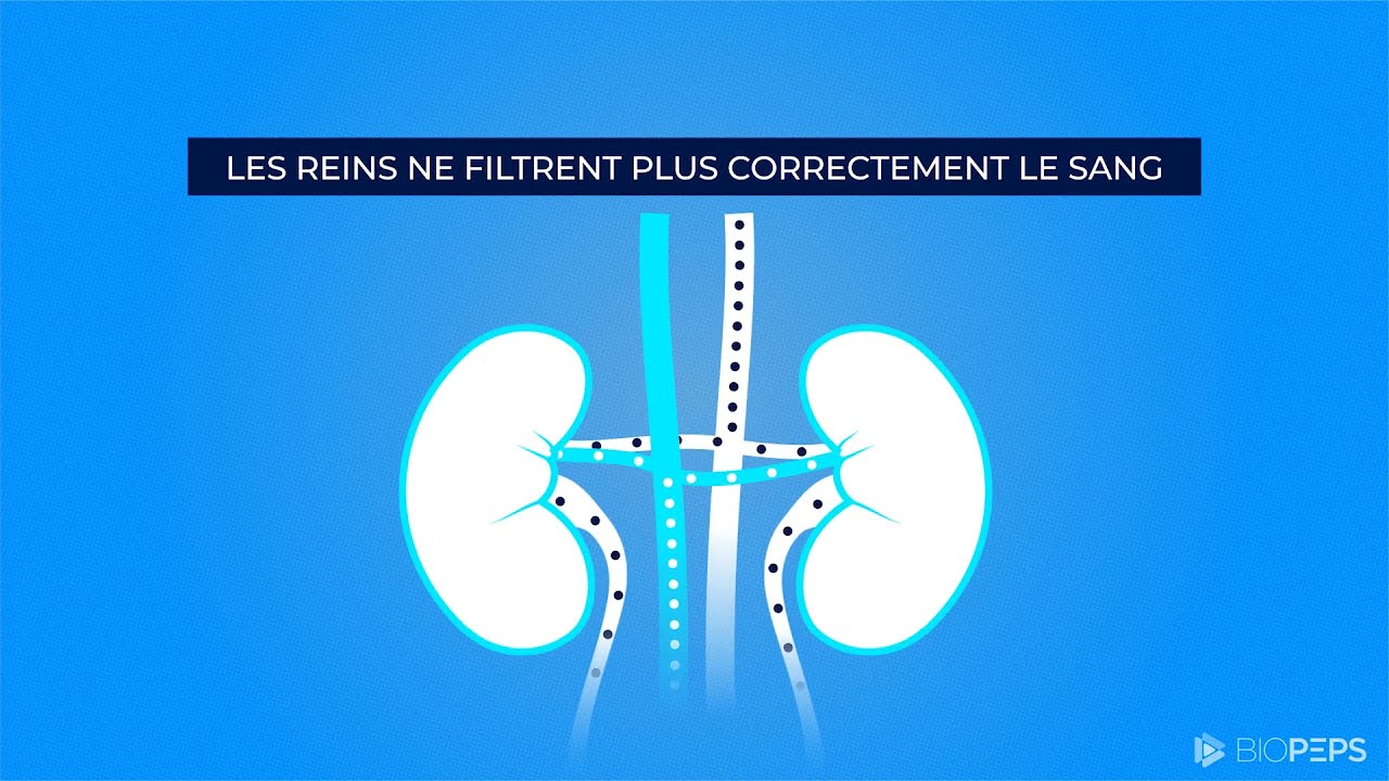 Comprendre la maladie chronique rénale