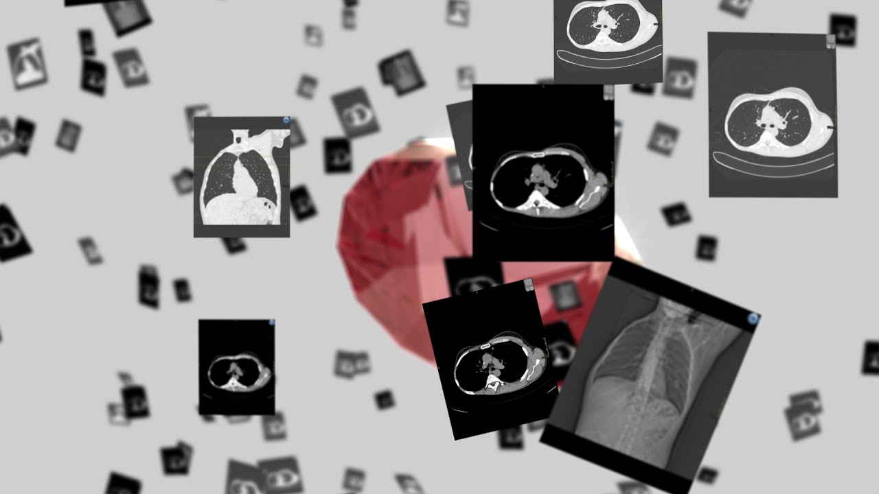 Agfa HealthCare RUBEE for AI