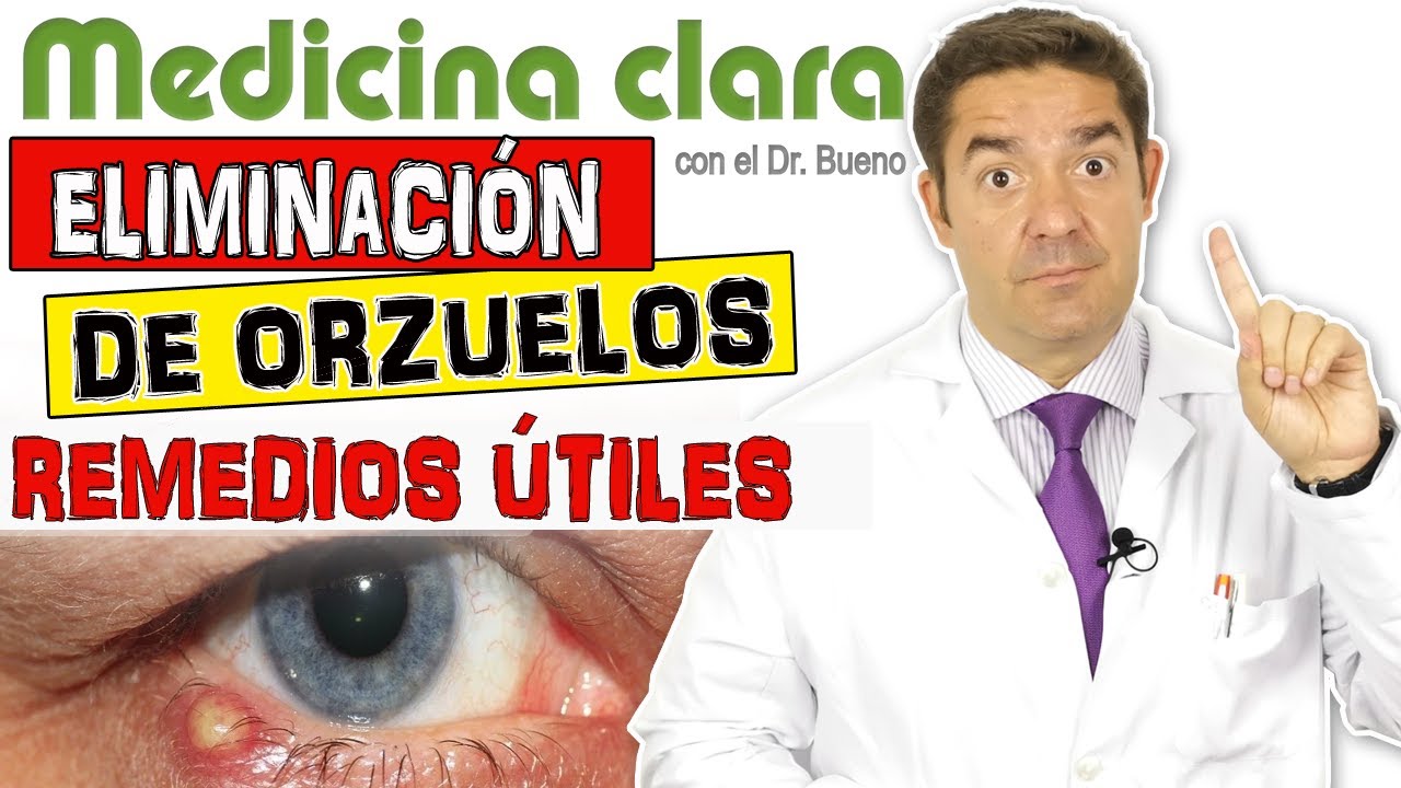 CURAR un ORZUELO | 6 REMEDIOS CASEROS &iquest;Cu&aacute;l es LA M&Aacute;S EFICAZ para SANAR? | Medicina Clara