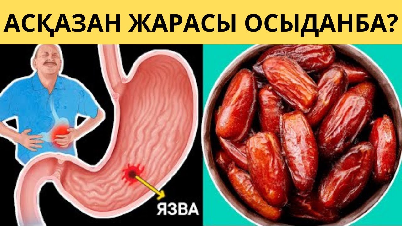 Изжога неден болады, Қышқылдық рефлюксті емдеу және симптомдарды тоқтату үшін үйдегі дәрі