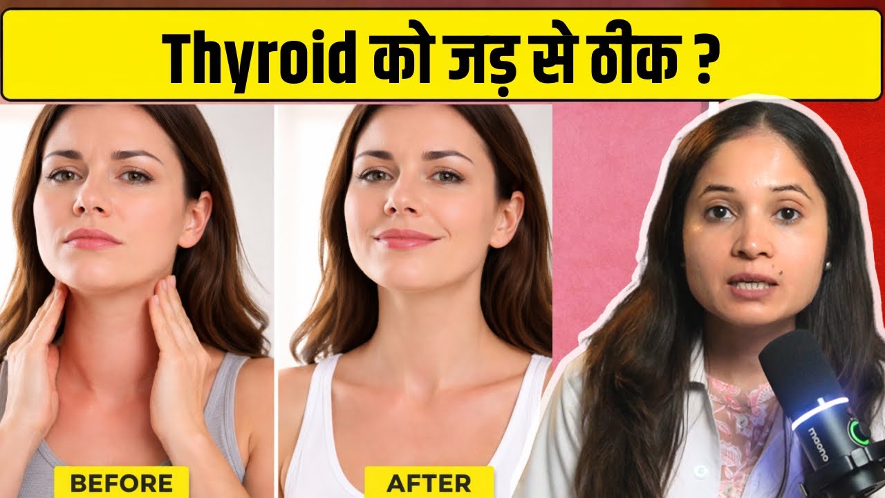 Hypothyroidism को Reverse कैसे करें? | Nutrition & Lifestyle से Thyroid Control