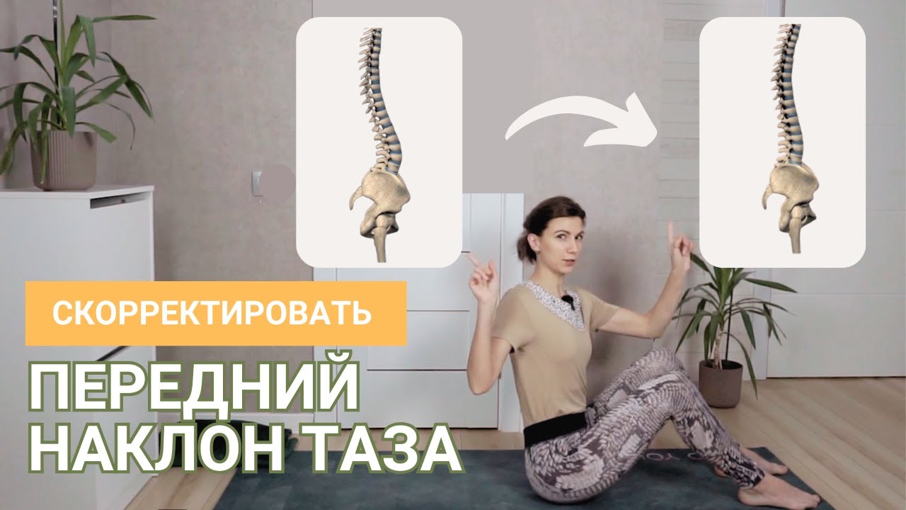 Комплекс при излишнем прогибе в пояснице | Убрать передний наклон таза | Коррекция гиперлордоза