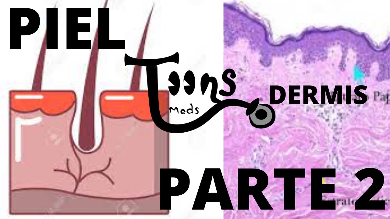 HISTOLOGÍA:PIEL (Parte 2)  DERMIS - CAPAS DE DERMIS,PECAS,LUNARES Y COLORACIÓN DE LA PIEL MedsToons
