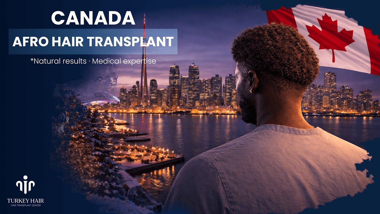 Canada Afro Hair Transplant Explained | Techniques, Results & What to Expect