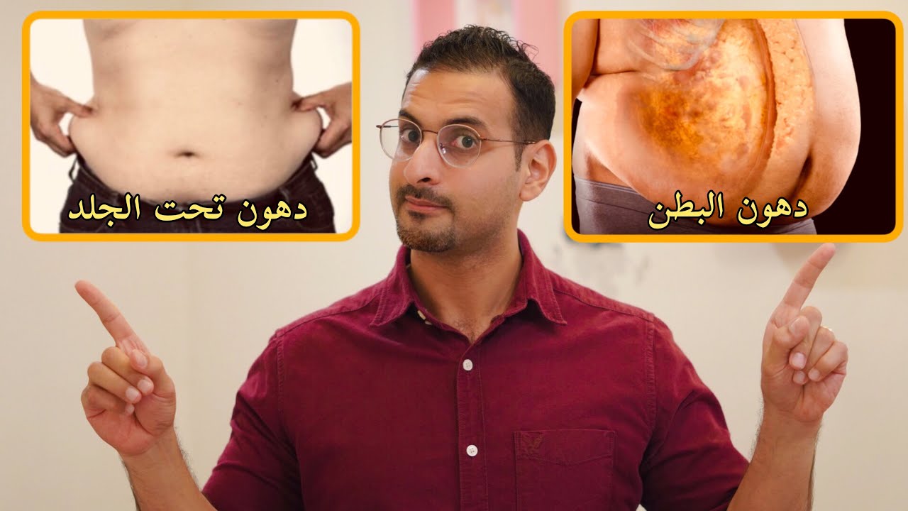 الفرق بين دهون البطن ودهون تحت الجلد، الطريقة الصحيحة للتخلص منها