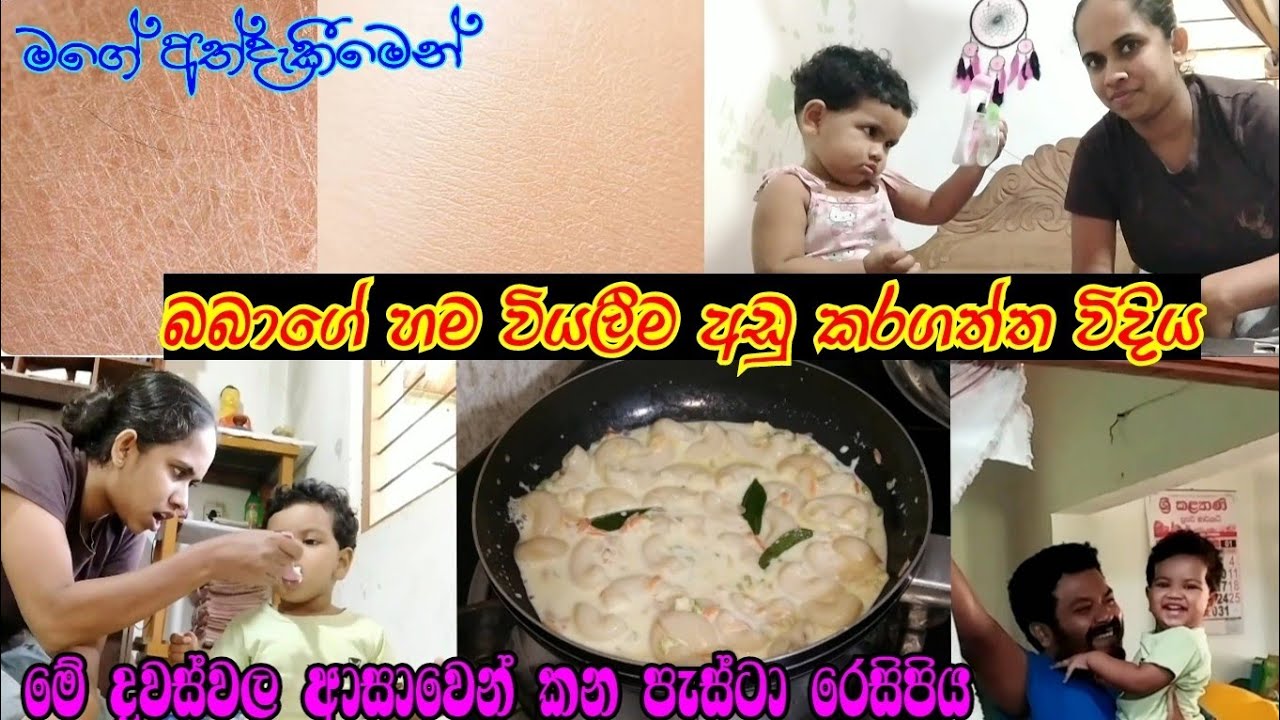 බබාගේ හම වියලීම පාලනය කරපු විදිය 