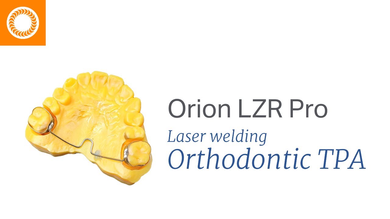 Laser Welding Ortho Transpalatal Arch (TPA) with the Orion LZR laser Welder by Sunstone