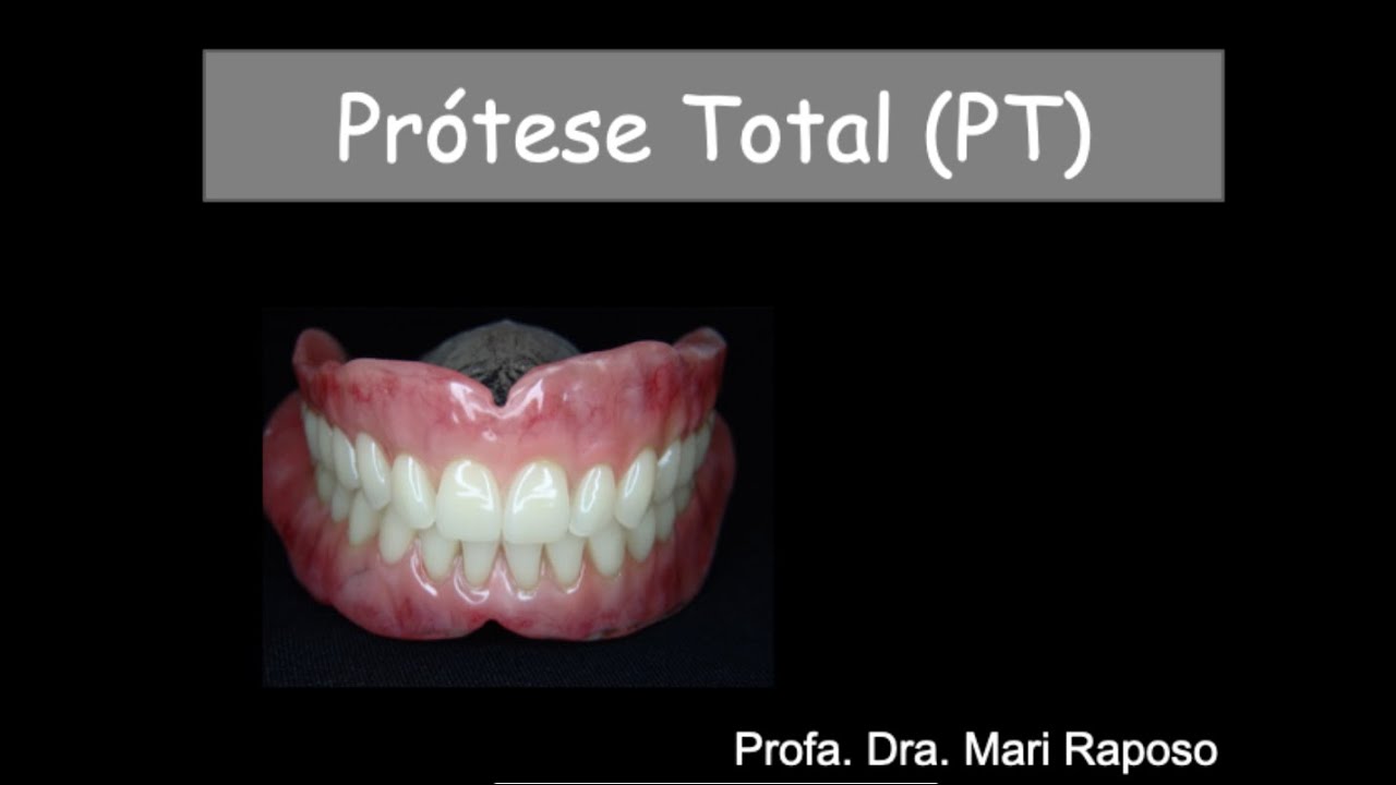 Aula Anamnese e Exame Clínico em Prótese Total - Parte I