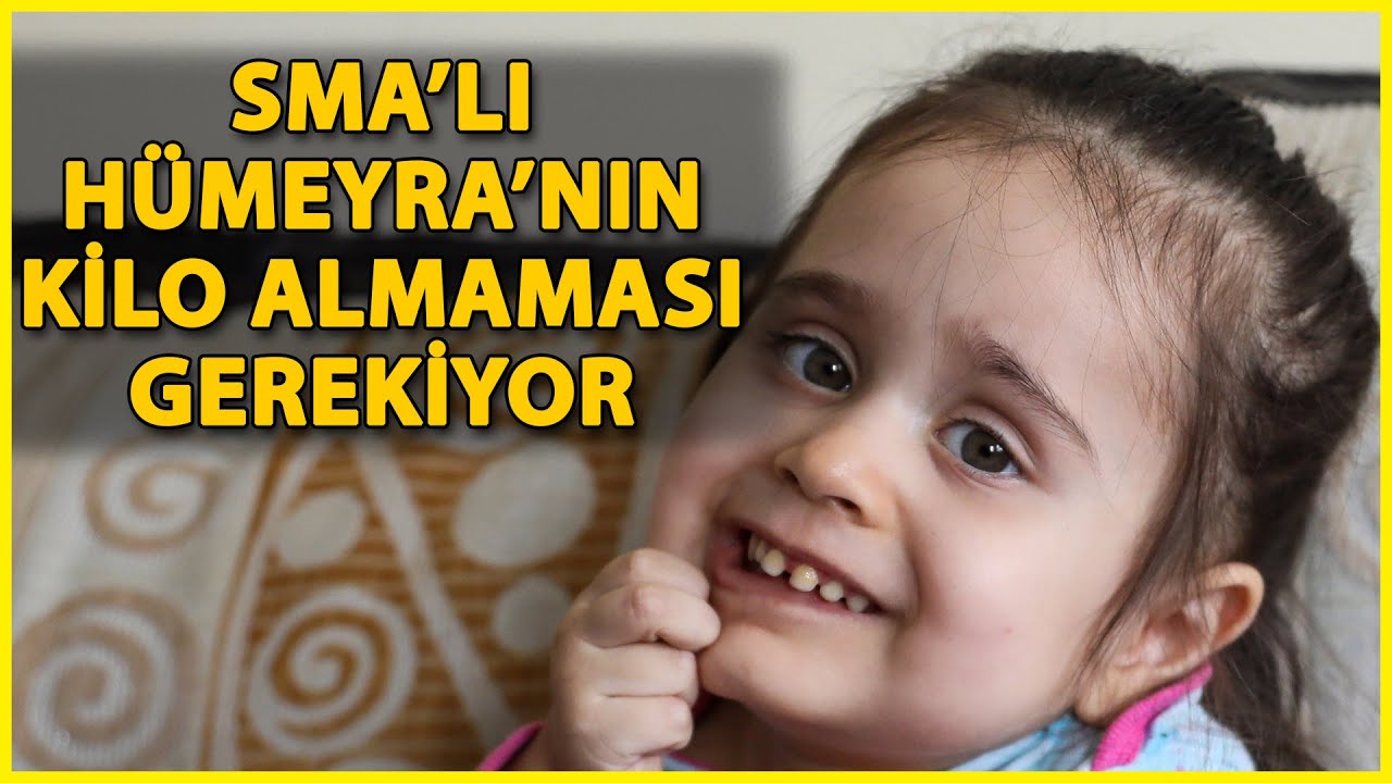SMA'lı Hümeyra, Kilo Almaması için Çok Sevdiği Çikolatadan Bir Parça Yiyebiliyor