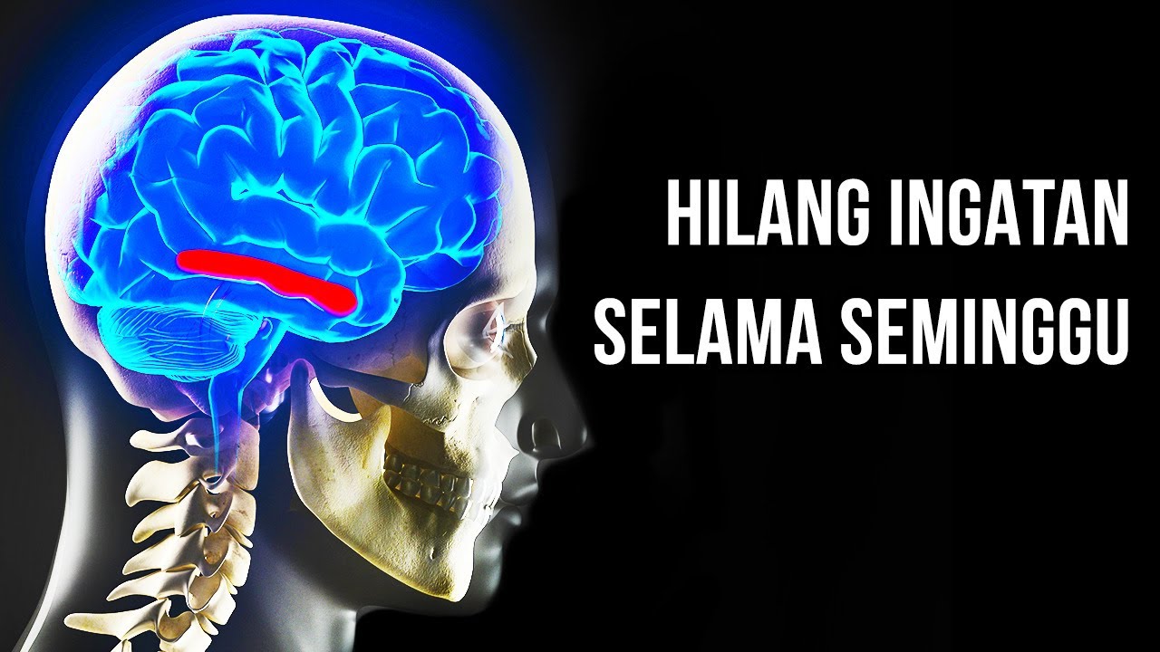 Bagaimana jika Seluruh Manusia Hilang Ingatan Sekaligus