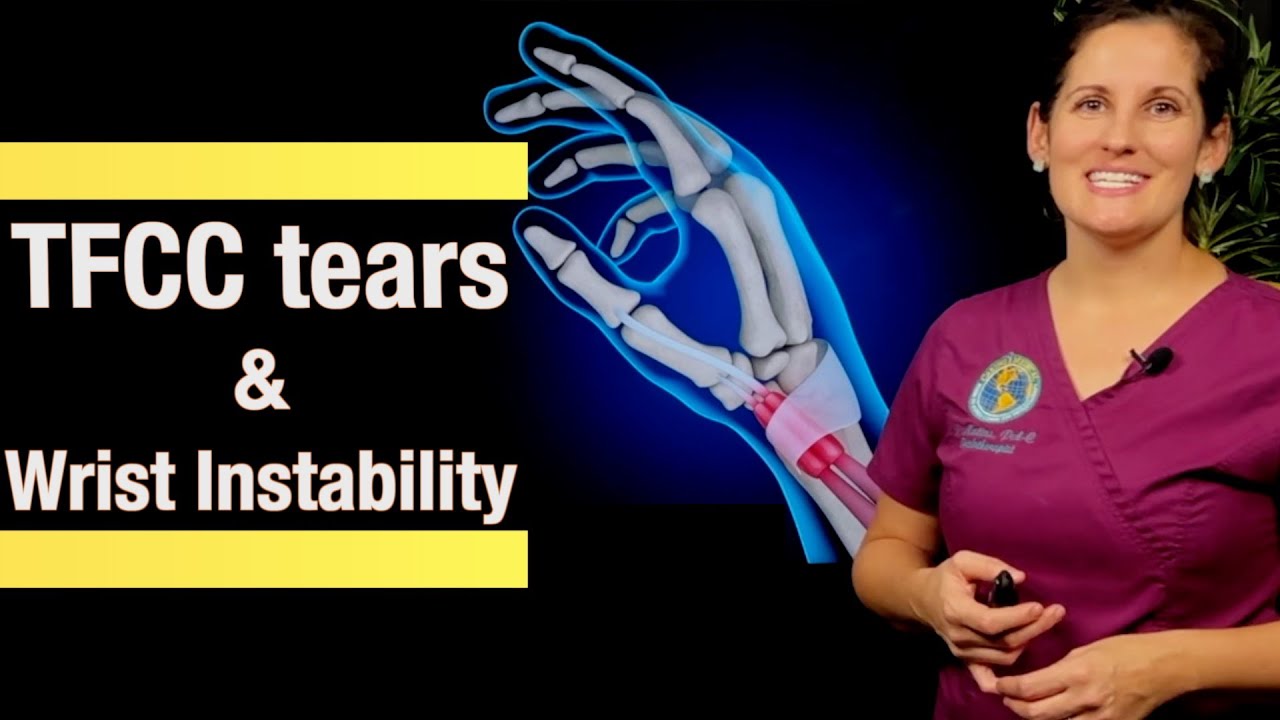 TFCC Tear injuries and Wrist Instability treated with Prolotherapy- nonsurgical TFCC repair
