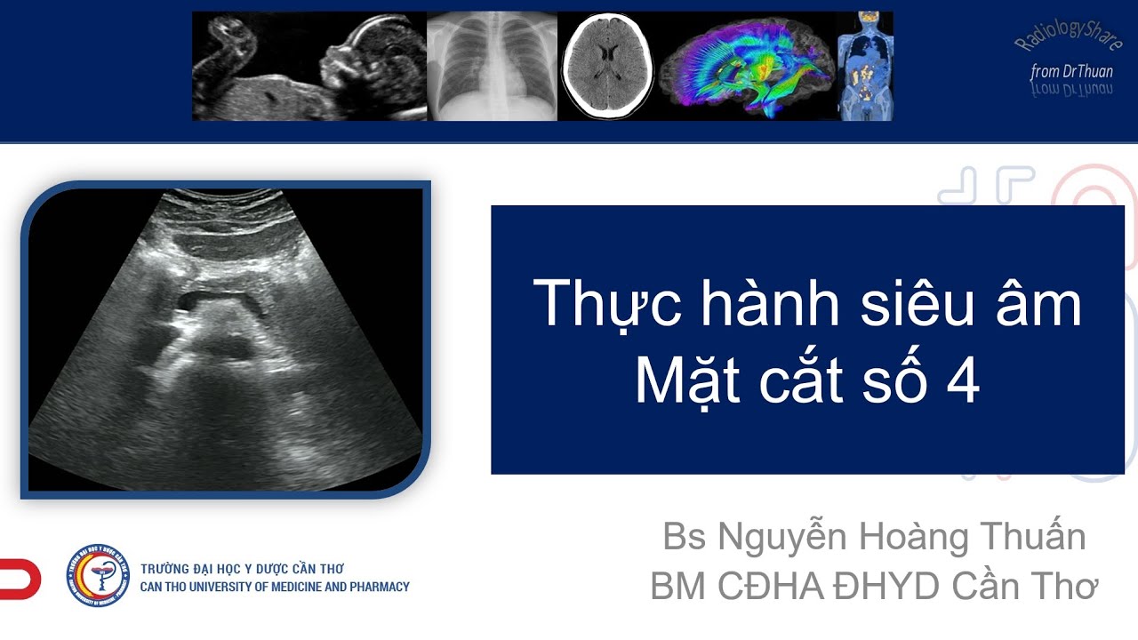 Hướng dẫn thực hành MCCB -2021- MC số 4