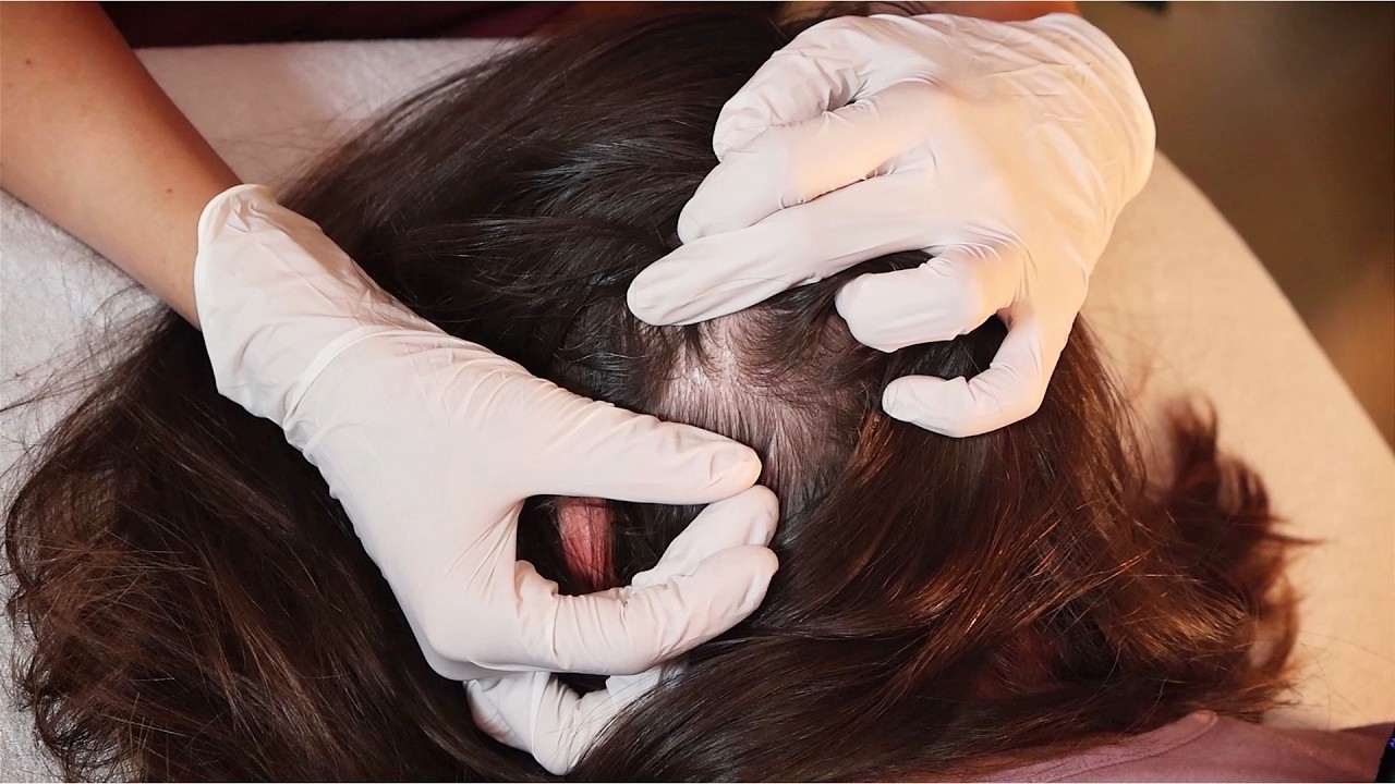 Close-up Skin Exam | Delicate and Tingly SCALP Check ASMR