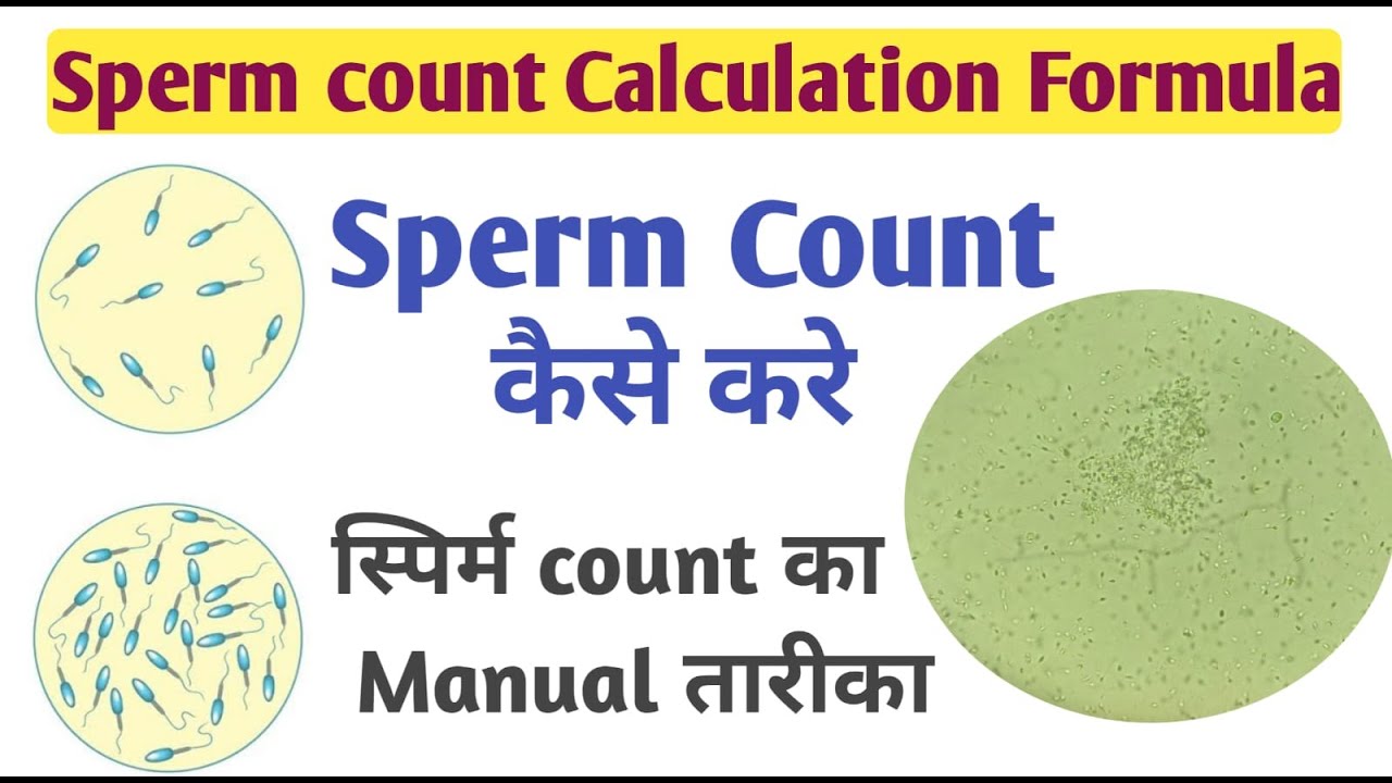sperm count calculation formula I how to count sperm in microscope I sperm count formula