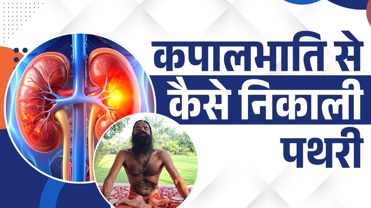 कपालभाति (Kapalbhati) से कैसे निकाली पथरी || Swami Ramdev