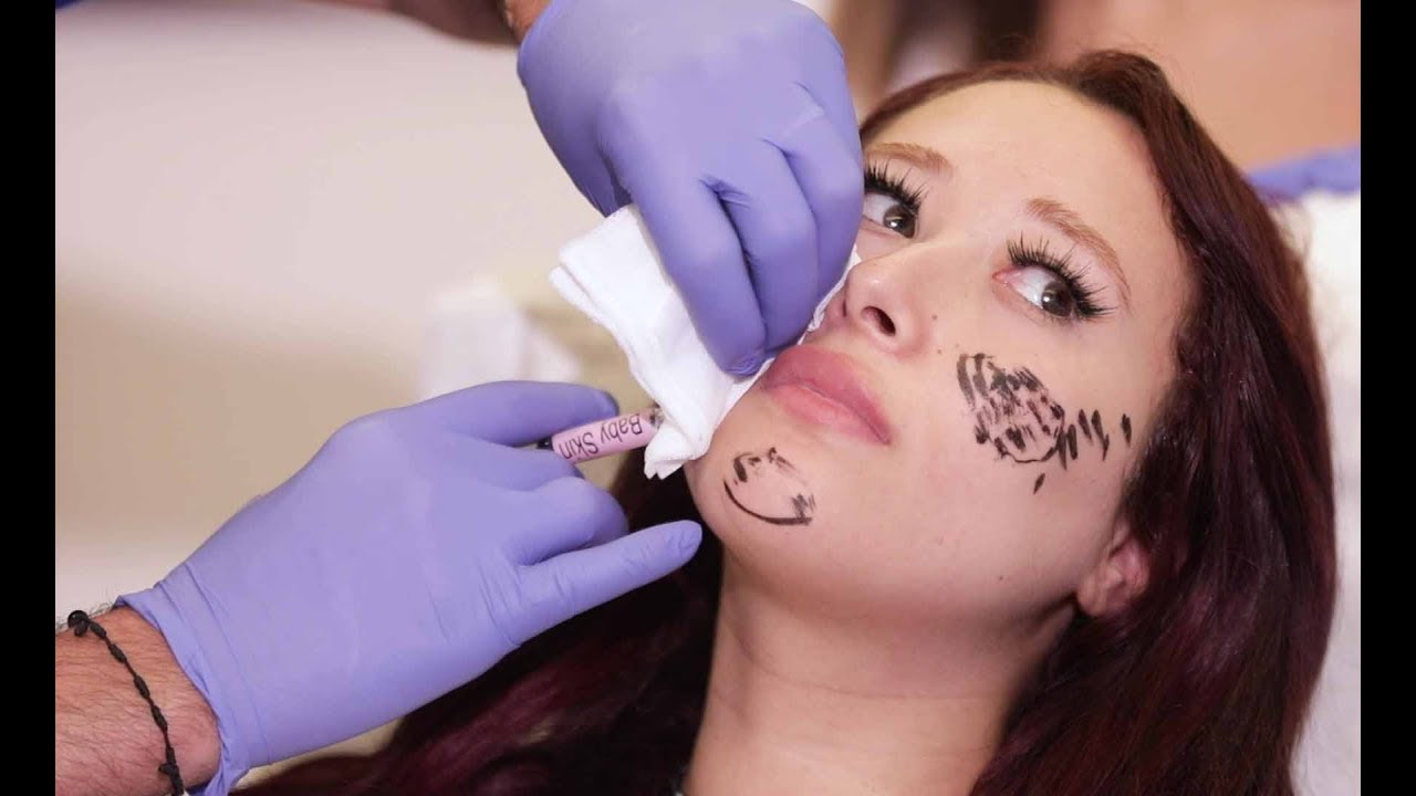 إستخدام Baby Skin والكافيار - الجمال نادر وصعب - الحلقة ١٧