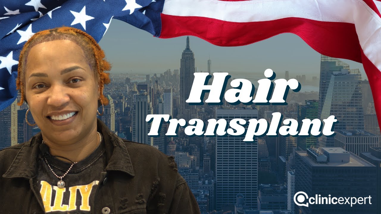 Female Hair Transplant | Watch Mrs. Natara's Experience in Istanbul Turkey | Hair Transplant Women