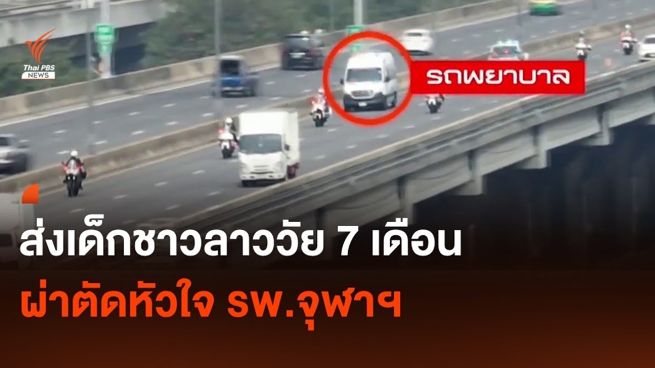 ภารกิจส่งเด็กชาวลาวมาผ่าตัดหัวใจใน กทม. เดินทางกว่า 500 กม. | Thai PBS News