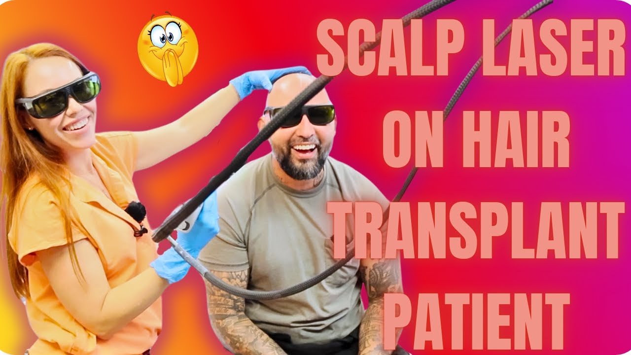 MY FIRST SCALP LASER HAIR REMOVAL AFTER HAIR TRANSPLANT | DID IT GO WELL?