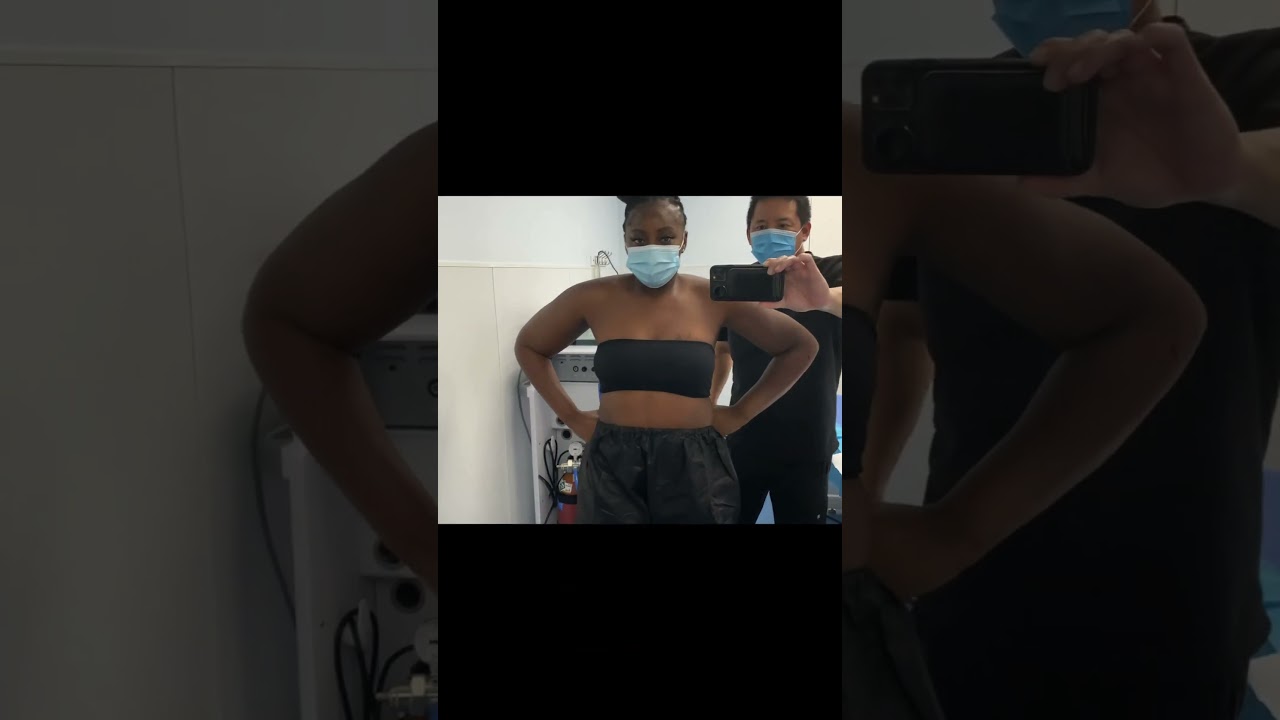 Celebrity Arms&trade; | 360&deg; Arm Liposuction | Immediate Results | Expert Dr. Thomas Su | Artlipo