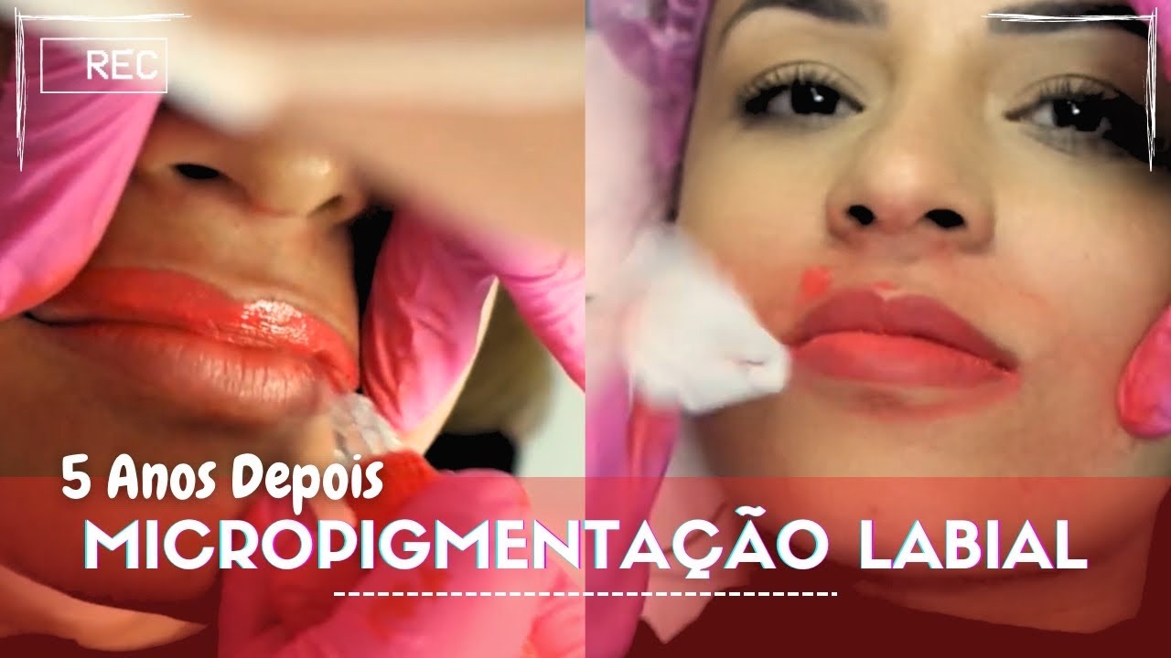 MICROPIGMENTAÇÃO LABIAL - o que aconteceu DEPOIS DE 5 ANOS
