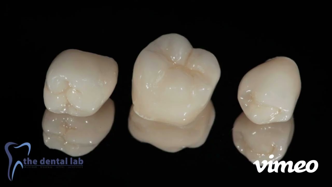 What is Lithium Disilicate?