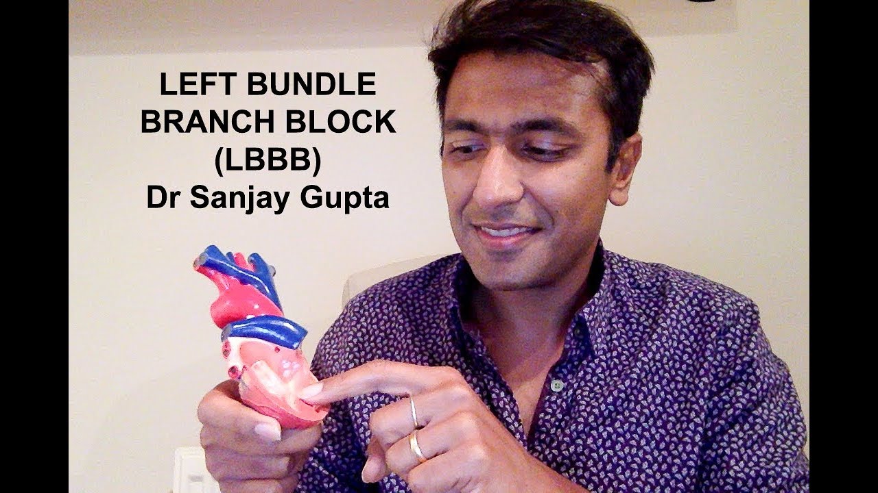 Left Bundle Branch Block