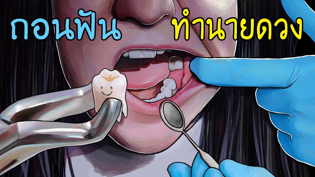 ถอนฟันทำนายดวงชะตา | ถอนหมดปาก