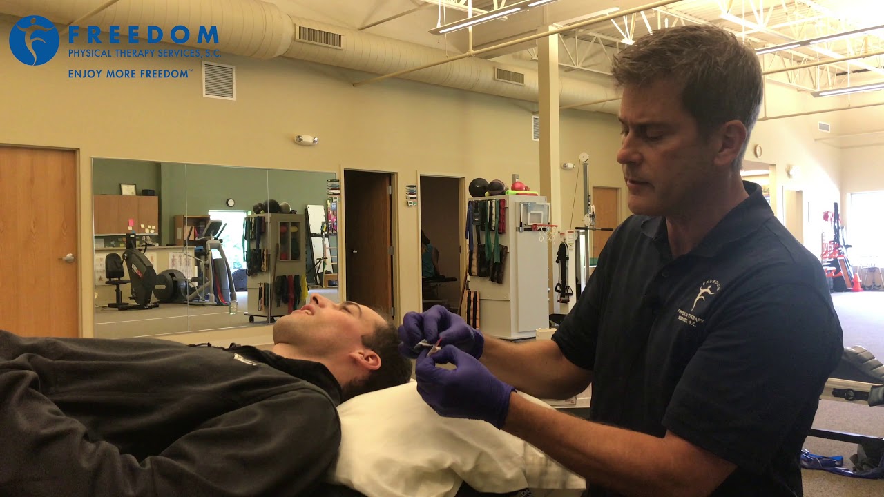 Dry Needling The Masseter Muscle with Jeff Verhagen