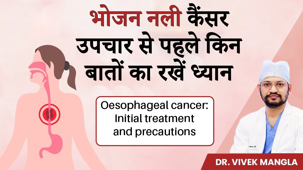 फूड पाइप कैंसर का शुरुवाती इलाज | Esophagus Cancer Treatment and Precautions | Dr Vivek Mangla