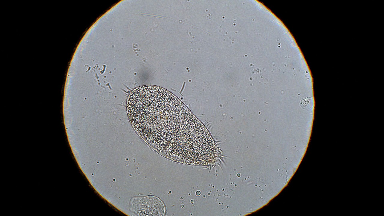 Ciliate: Hypotrichia, maybe Oxitricha