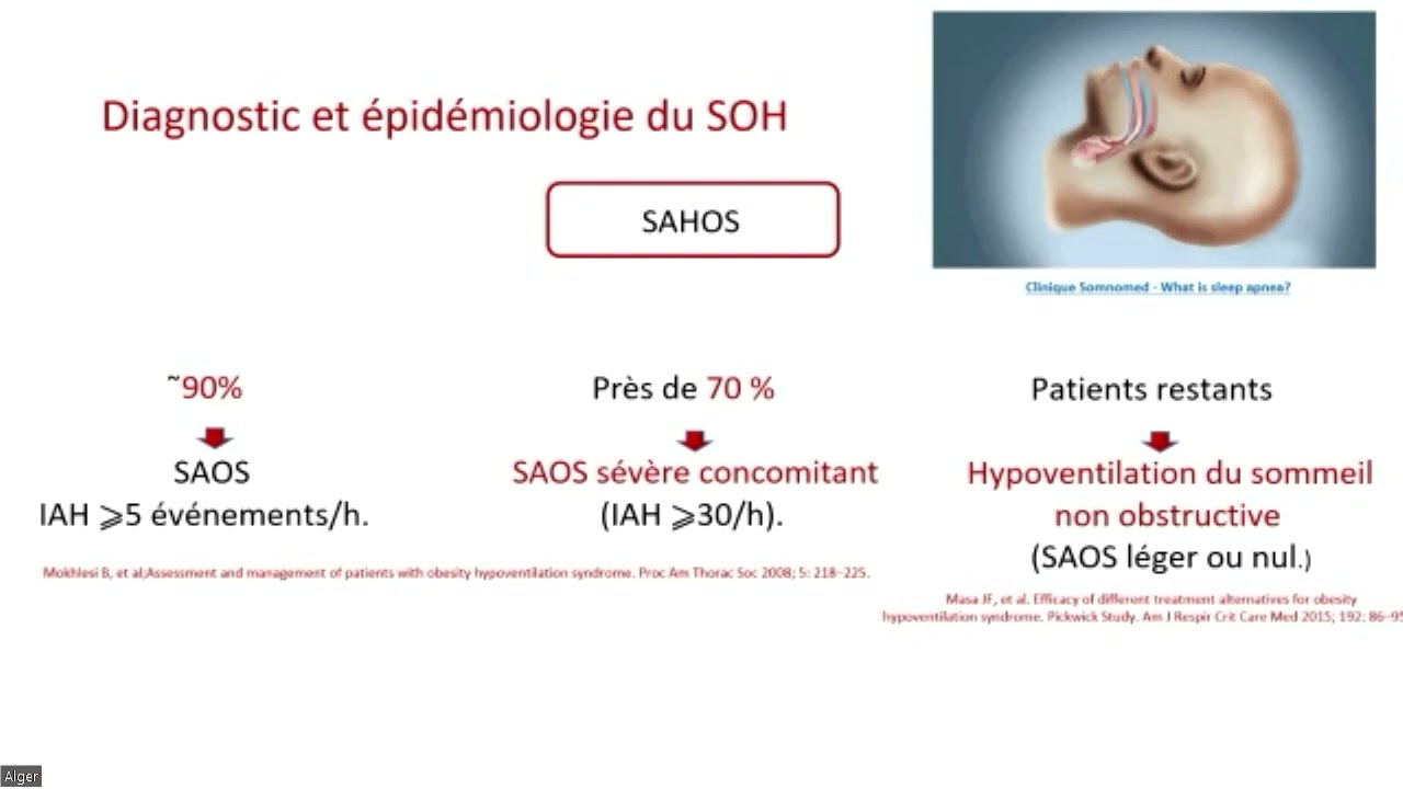 Syndrome Obésité Hypoventilation : Quoi de neuf ? : Dr A.NEHAL , APAL 29 SEPTEMBRE 23 , ESHRA ALGER