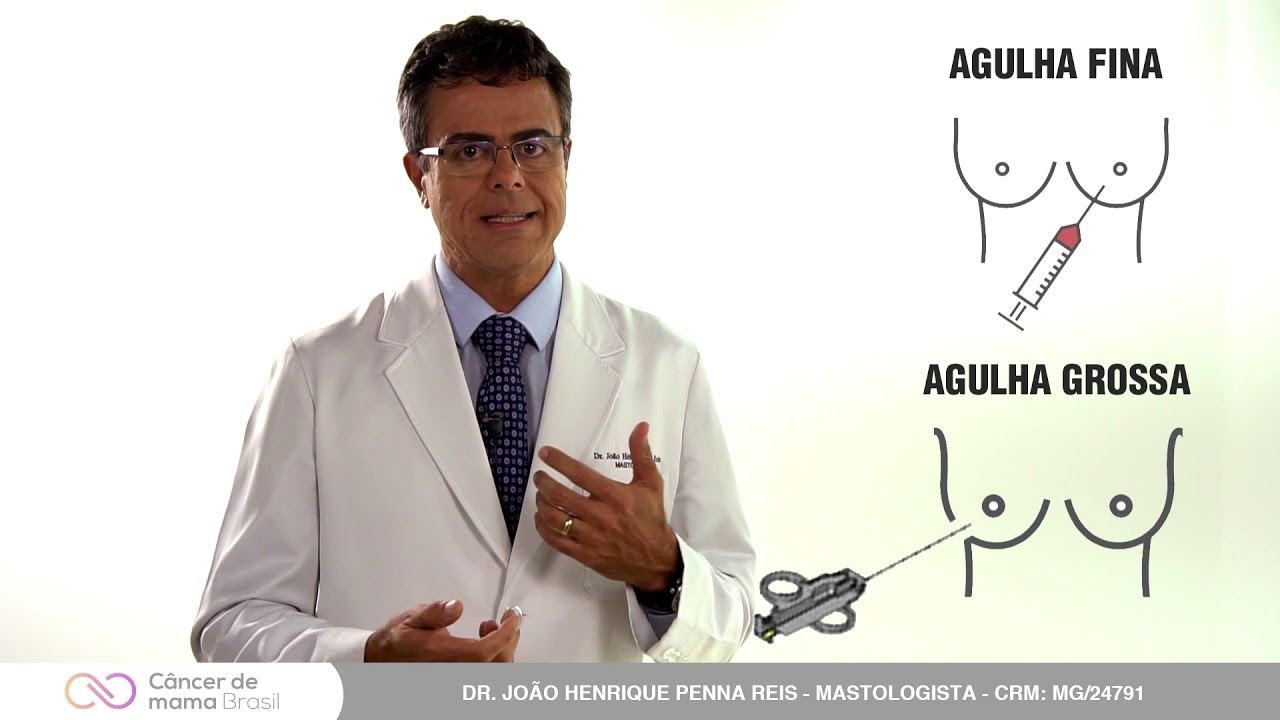 QUAL A MELHOR BIÓPSIA MAMÁRIA?