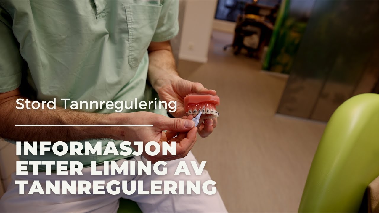 Informasjon etter liming av tannregulering - Stord Tannregulering