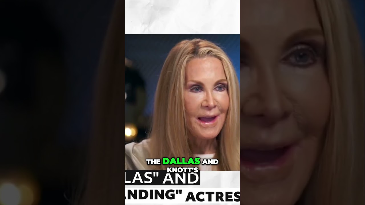 Joan VanArk's Shocking Cosmetic Transformations Revealed!